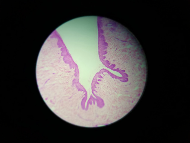 Stratified Squamous Epithelium Slides - Stratified Squamous Epithelium 03 40X